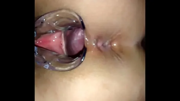 Hot Inside the pussy with vaginal speculum best Videos