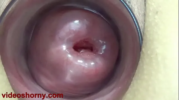 Hot Cervix Fucking pumped uterus prolapsed and t.. b. a. pussy and tormented best Videos